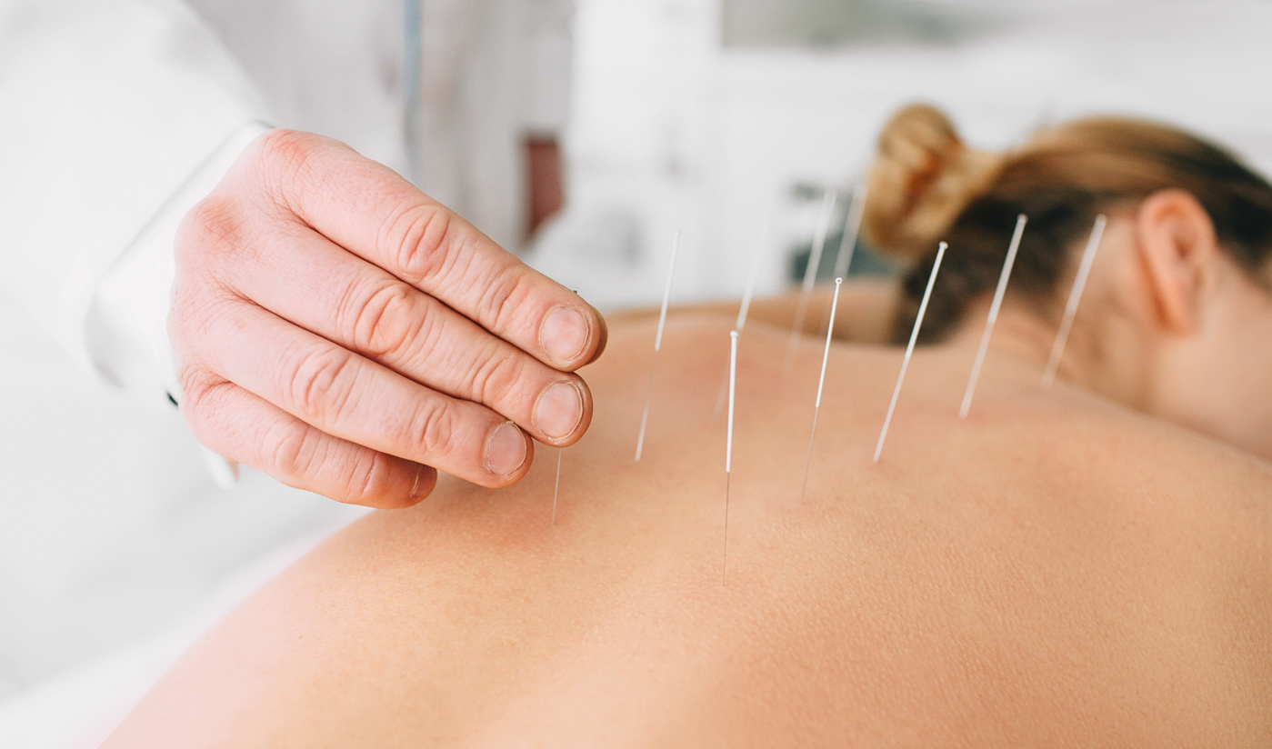 Eine Patientin nimmt eine Akupunktur in Anspruch, die wohl bekannteste TCM-Behandlungsmethode.